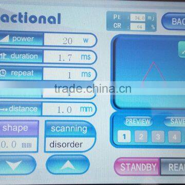 Fractional Co2 Laser POP IPL China Factory Co2 Laser Producers photo-6