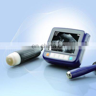 Full Digital Black and White Laptop Doppler Diagnostic System Ultrasound photo-4