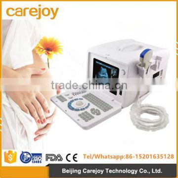 CE ISO approved Full Digital Imaging Technology 10-inch monitor 2 probe connector usb pc based ultrasound scanner China