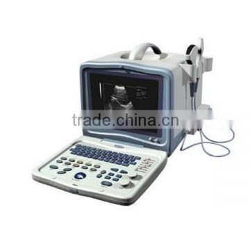 FM-9000A Full Digital Portable Ultrasound Scanner for hospital