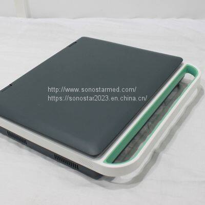 C5Pre Laptop Color Doppler