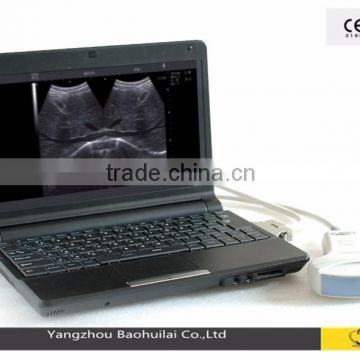 CX6000B Notebook Digital Diagnostic Ultrasound System