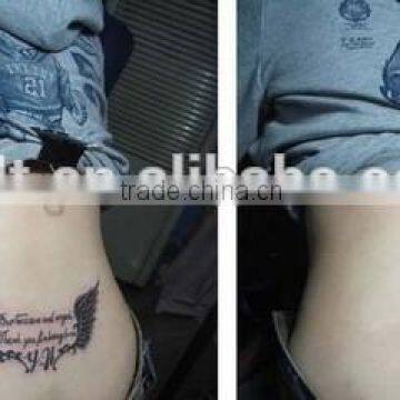 Portable Tattoo Removal Q-switch1064 nm 532nm nd Yag Laser Machine for Home Use photo-5