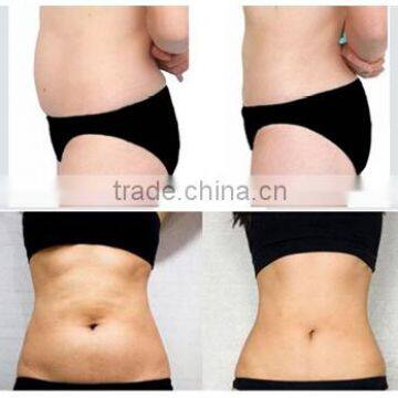 Deep Wrinkles Hifu Lose Skin Tightening Weight /hifu Machine/hifu With CE High Frequency Acne Machine