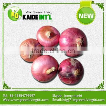 Best Selling Products In America Fresh On Sale Onion