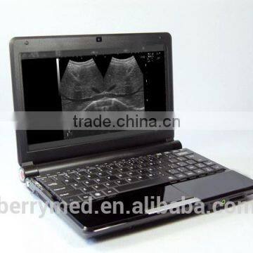 Econimic type B Mode Ultrasound Scanner machine Laptop portabe