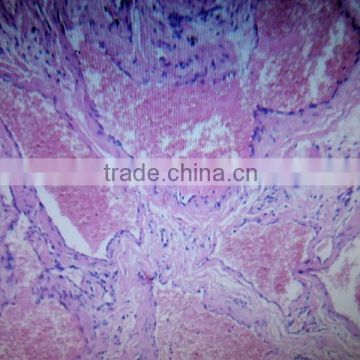 Histology oral pathological human prepared slides