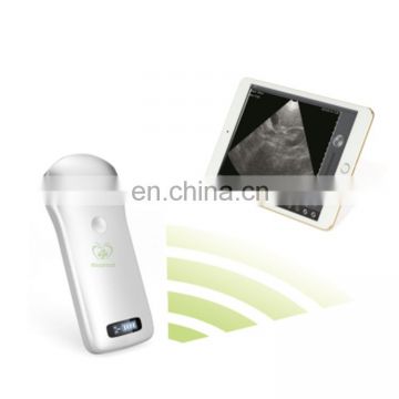 MY-A010C Top quality medical wireless ultrasound probe handheld ultrasound scanner with tablet screen