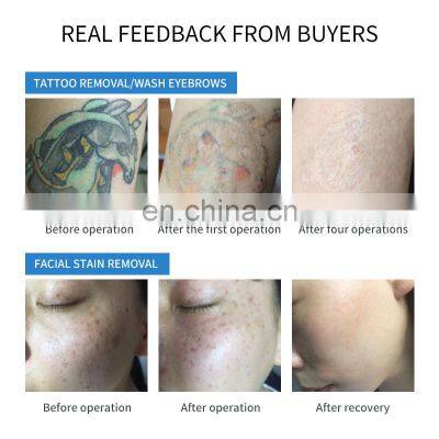 Q Switched ND Yag Laser Tattoo Removal Machine Eyebrow Pigment Freckles Blackhead Removal Skin Rejuvenation Beauty Instrument photo-5