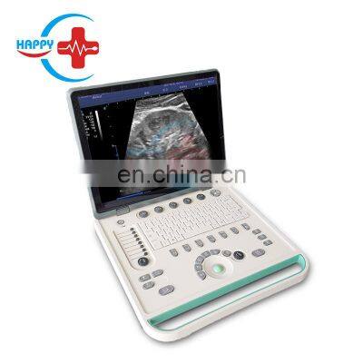 HC-A006A Hot sales ultrasound scanner 3d 15 inch LED ultrasound scanner medical equipment