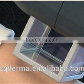 308nm portable handheld home use 308nm Mini excimer vitiligo treatment equipment for vitiligo