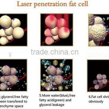 Medical CE ISO 13485 Machine/ Laser Slimming Machine for Fat Reducing photo-5