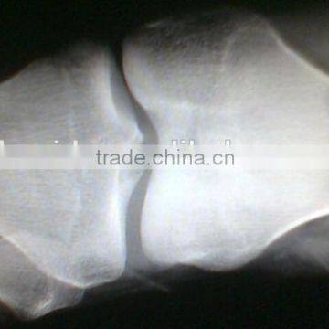 Medical Dry Film, x ray film from manufacturer