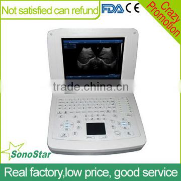 Sonostar good quality handheld portable vet ultrasound scanner pig veterinary ultrasound V10(SS-10V )