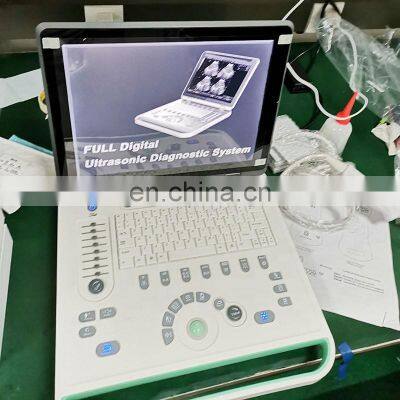HC-A006B Full Digital 15 Inch Laptop Ultrasound Machine With Competitive Price(ARM Based) photo-5