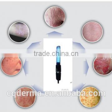 Narrow band UVB phototherapy 311nm narrow band uvb lamp for psoriasis treatment