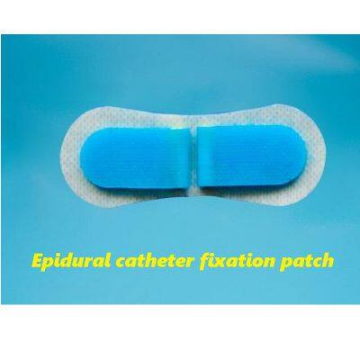 Epidural catheter fixation