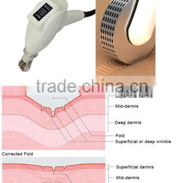 Remove Pigmentation Machine Innovative Products For Import Missface-80