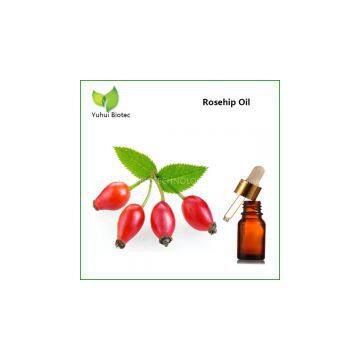 Rosehip Oil