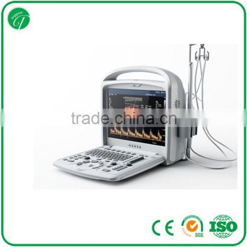 Diagnostic Ultrasound Machine/Medical coller Doppler Machine K3