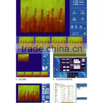 Hotsale Microcirculation Image Analyzer From China