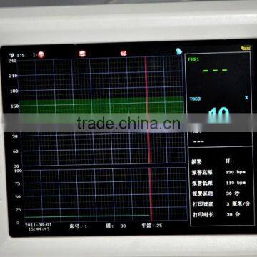 8.4-inch Screen Color LCD Display, Rotate Screen to 60 Degreen Fetal Monitor RFM-300A-Shelly photo-6