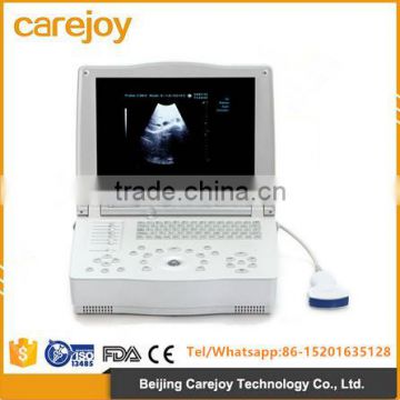 2016 new 15-inch Laptop Ultrasound Scanner with low price