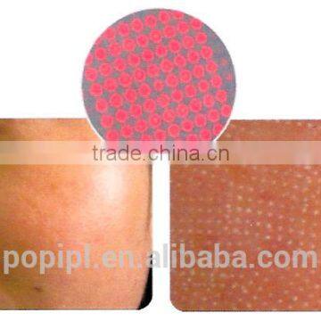 Laser Resurfacing photo-3