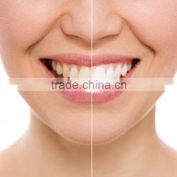 Teeth Whitening Spa Starter Package photo-5