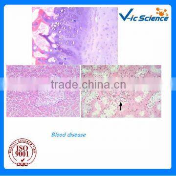 China supplier hematopathy prepared microscope glass slides for teaching and lab survey