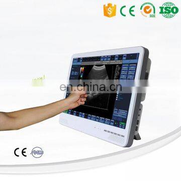 MY-A023A Flat Touch Screen Color Doppler B Ultrasound Panel USG System Ipad Ultrasound Machine