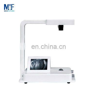 Table top/Portable medical infrared vein viewer finder machine for finger Vascular detector illuminator