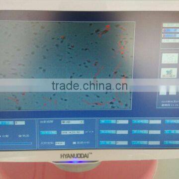 Cheap Sperm Quality Analyzer for Hot Sale photo-4