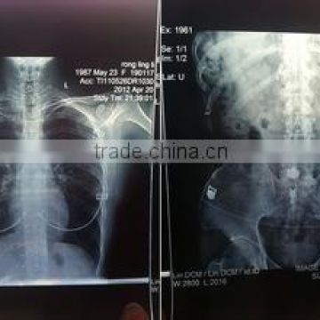 Economic x-ray film/ dry medical film, chinese manufacture medical x ray film