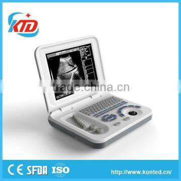 Portable b Ultrasound Scanner Price With High Quality for Wholesales