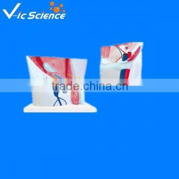 Inguinal model teaching groin anatomy plastic model