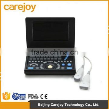 2016 new Laptop Ultrasound machine / Scanner PC platform with CE ISO certification