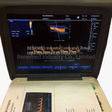 Популярный портативный цветной допплеровский ультразвуковой сканер медицинское оборудование для больниц photo-3