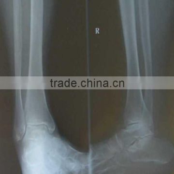 medical thermal x ray film,medical consumable item ,x ray blue film