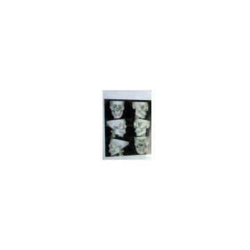 Meidcal double-side dry film(CT-9)