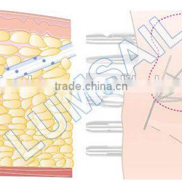 LUMSAIL Vaser Tumescent Liposuction Machine BS-LIPS5 photo-5