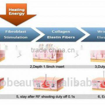 High Quality Fractional rf Facelift Machine/rf Micro Needle Remova Stretch Marks/fractional rf Facetreatment Machine