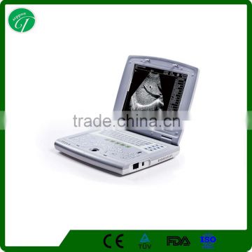 laptop ultrasound hospital USG 3D laptop cardiac ultrasound KX5000