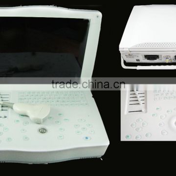 CE approved Portable Ultrasound Scanner with 3.5Mhz multi-frequency convex probe RUS-9000E