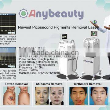 800mj Beauty Distributors Q-switched Nd Yag Tattos Removal Laser Machine Prices 1064nm