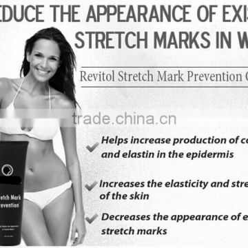 Best slimming cream, stretch mark cream