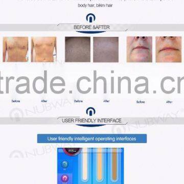 Germany Beauty Laser Equipment Permanent Alexandrite 808nm Diode Laser Body Hair Removal System for Hair Removal photo-6