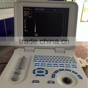 Laptop Ultrasound Scanner & Ultrasound Scanner For Horse