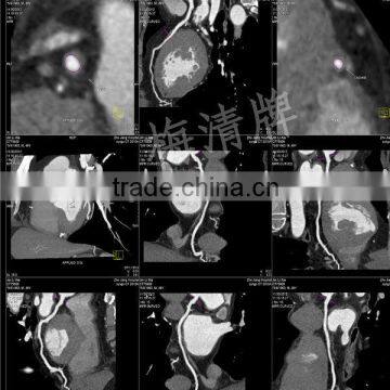 Medical surgical film