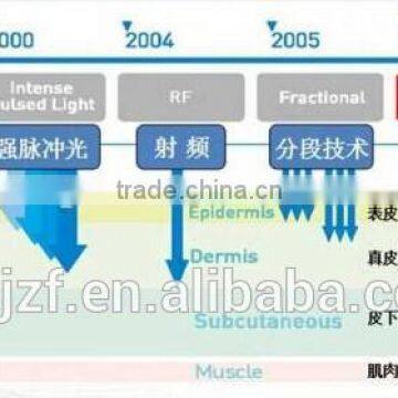 Anybeauty Hot Sale HIFU-C Wrinkle Removal Double Chin Removal Machine
